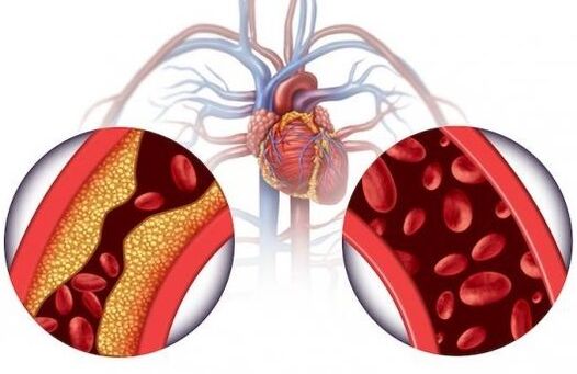 Το Welltone αποτρέπει την αγγειοσύσπαση - αντιγραφή